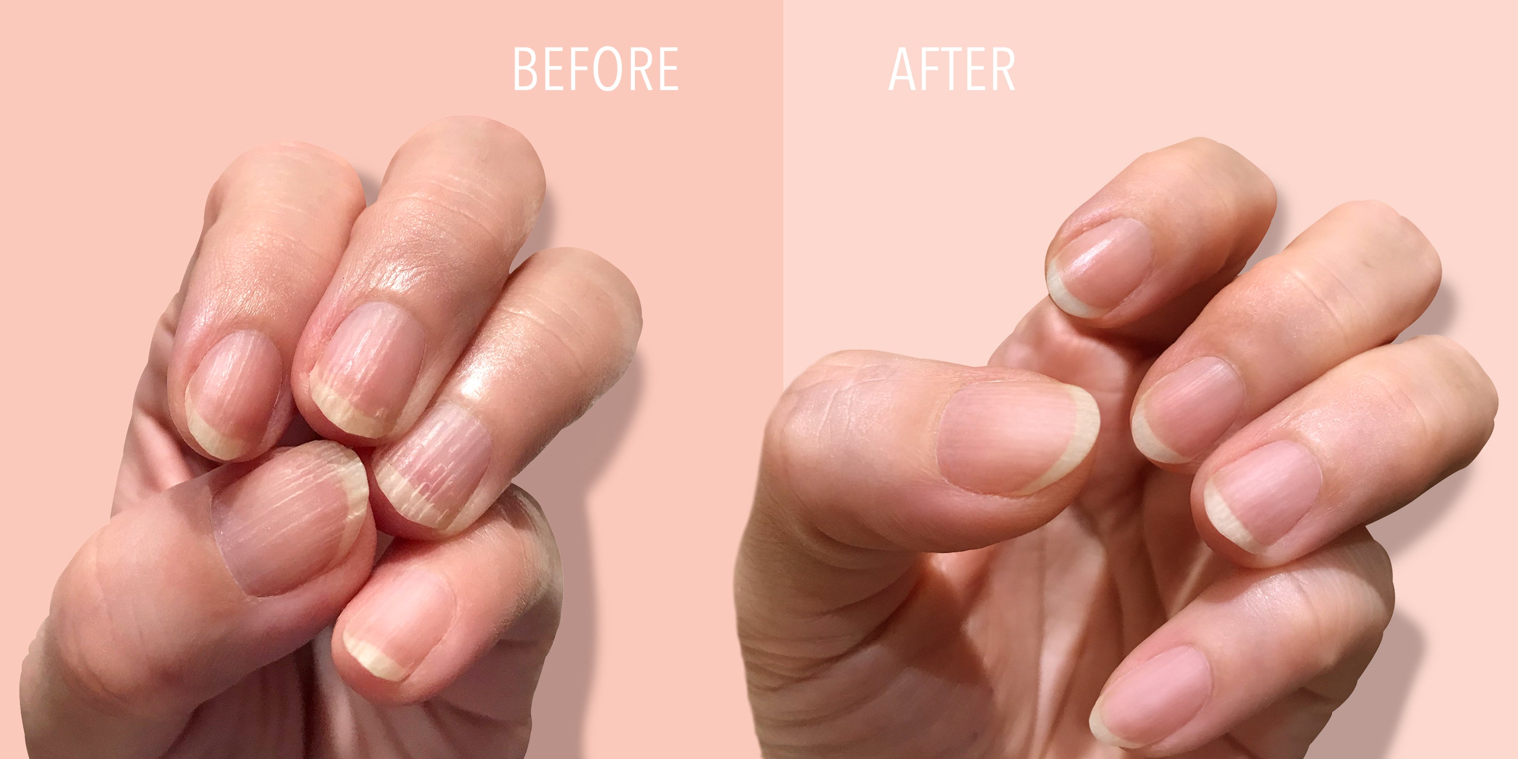 Ridged sales thumb nails