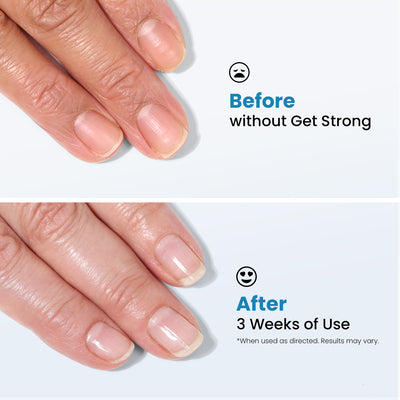 Comparison of fingernails before and after three weeks of using LONDONTOWN's Get Strong Nail Hardener. The top image shows weak nails, while the bottom image displays stronger and healthier nails, highlighting the superior nail care provided by this product for achieving the strongest nails.