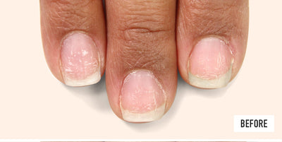 Nail Probiotic Instant Boost