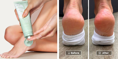 What Does Foot Cream Do: Benefits and Uses