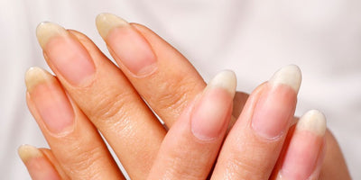 Why Are My Nails Orange After Removing Nail Polish?