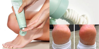 Why Are My Feet So Dry: Causes and Solutions