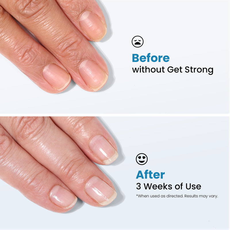 Comparison of fingernails before and after three weeks of using LONDONTOWN's Get Strong Nail Hardener. The top image shows weak nails, while the bottom image displays stronger and healthier nails, highlighting the superior nail care provided by this product for achieving the strongest nails.