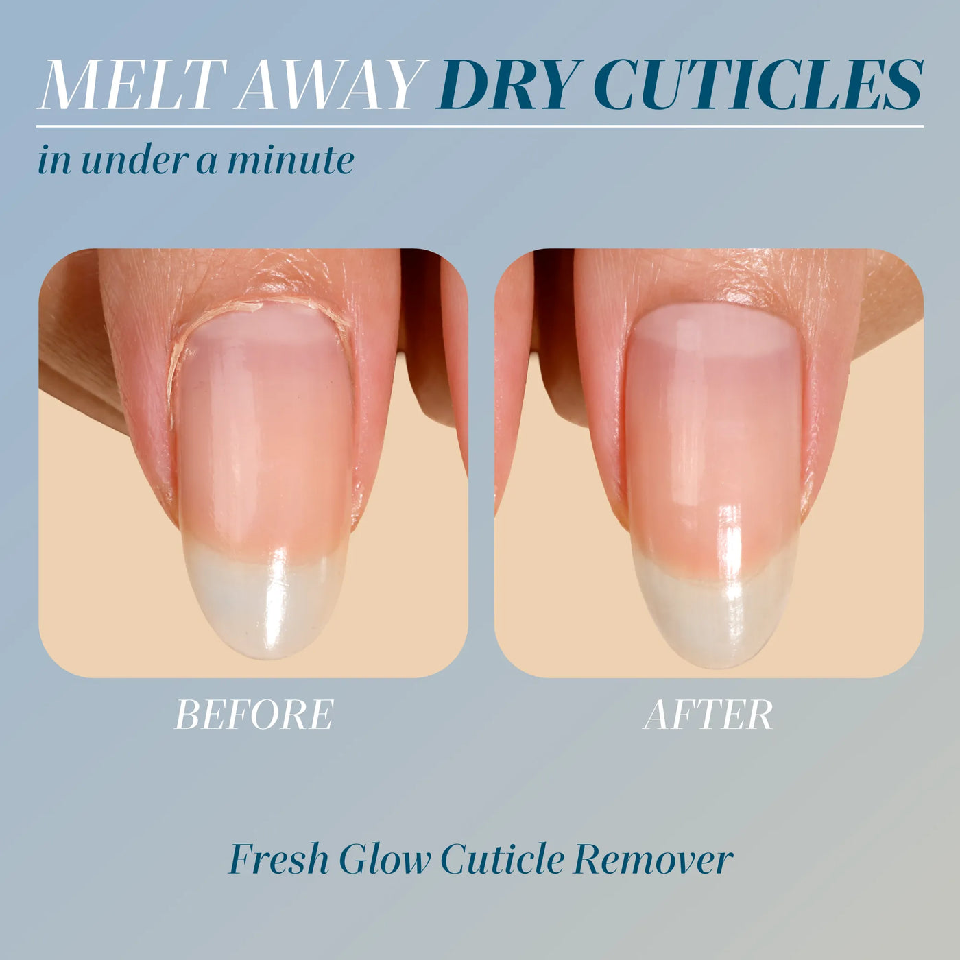 Cuticle Care Set | Cuticle Refresh | LONDONTOWN