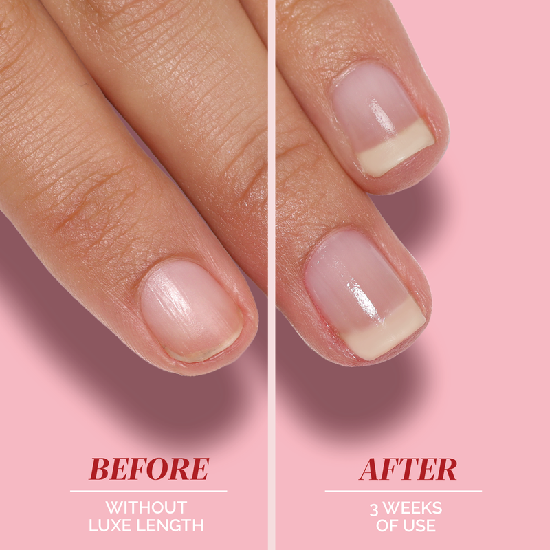 Side-by-side close-up of a fingernail before and after three weeks using LONDONTOWN Luxe Length Nail Gloss, highlighting longer nails, enhanced appearance, and a healthy shine.