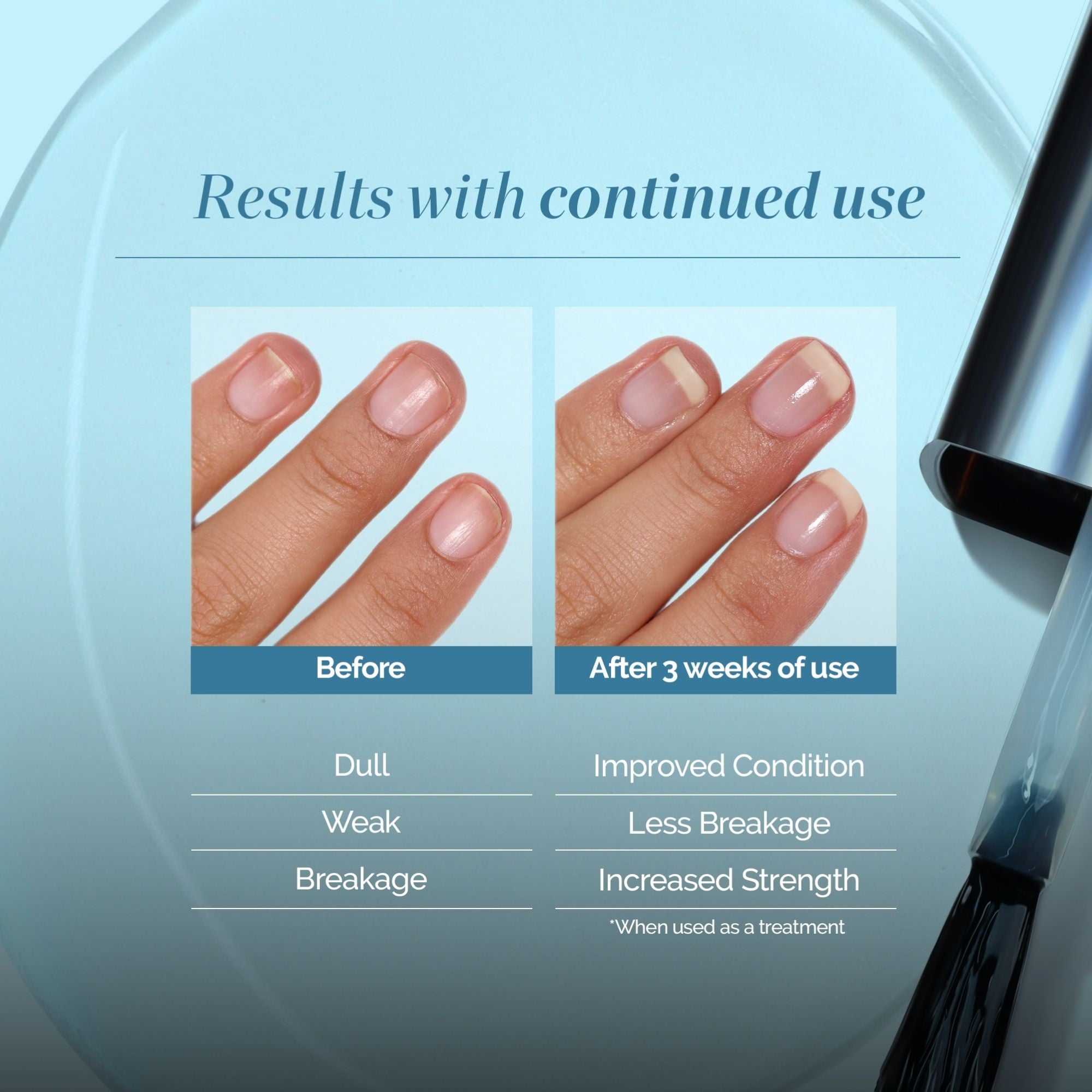 Side-by-side comparison of fingernails before and after 3 weeks using LONDONTOWN Get Strong Nail Hardener shows visible improvement in nail condition and strength, with reduced breakage for the strongest nails yet.