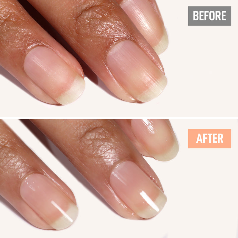 A close-up of fingernails in two panels: "before" shows thin, weak nails, while "after" reveals smoother, glossier nails after using LONDONTOWN Nail Probiotic Instant Boost.