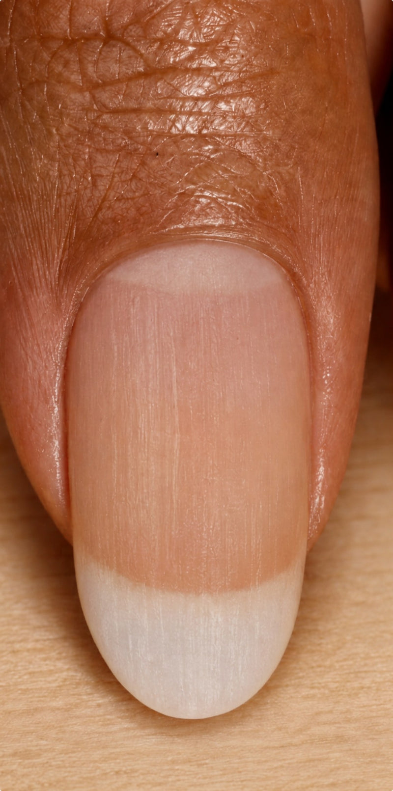 Dry, brittle nail before Luxe Length