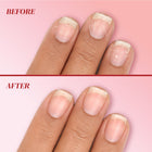 Split image shows fingernails before with dryness and damage, and after with smoother, healthier nails thanks to LONDONTOWN Peptide Serum Concentrate.