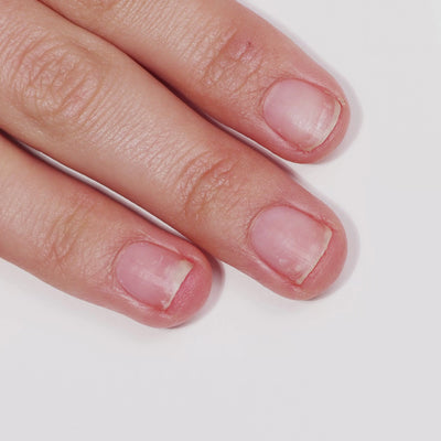 Get Well Nail Recovery