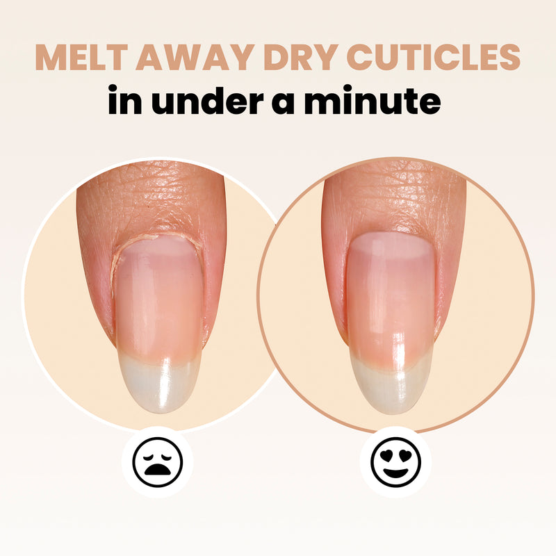 Before and after image of a fingernail with overgrown cuticles on the left and moisturized cuticles on the right, using frowny and smiley face icons below to illustrate the transformation. Text: "Transform dry cuticles in under a minute with LONDONTOWN's Fresh Glow Cuticle Remover.