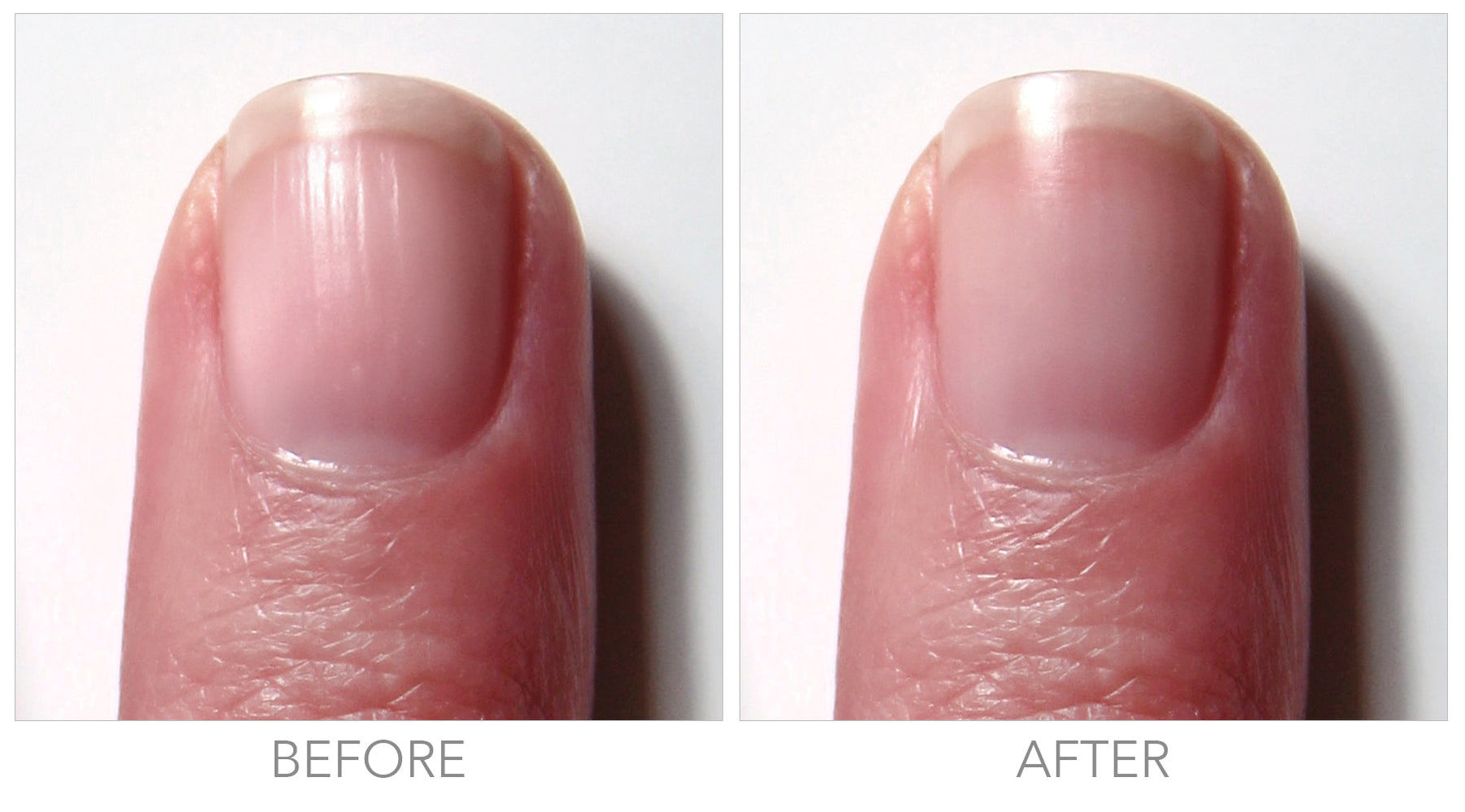 Fortifying Ridge Filler For Flawless Nails | Nail Care | LONDONTOWN