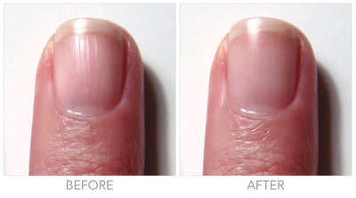 Fortifying Ridge Filler (Professional)