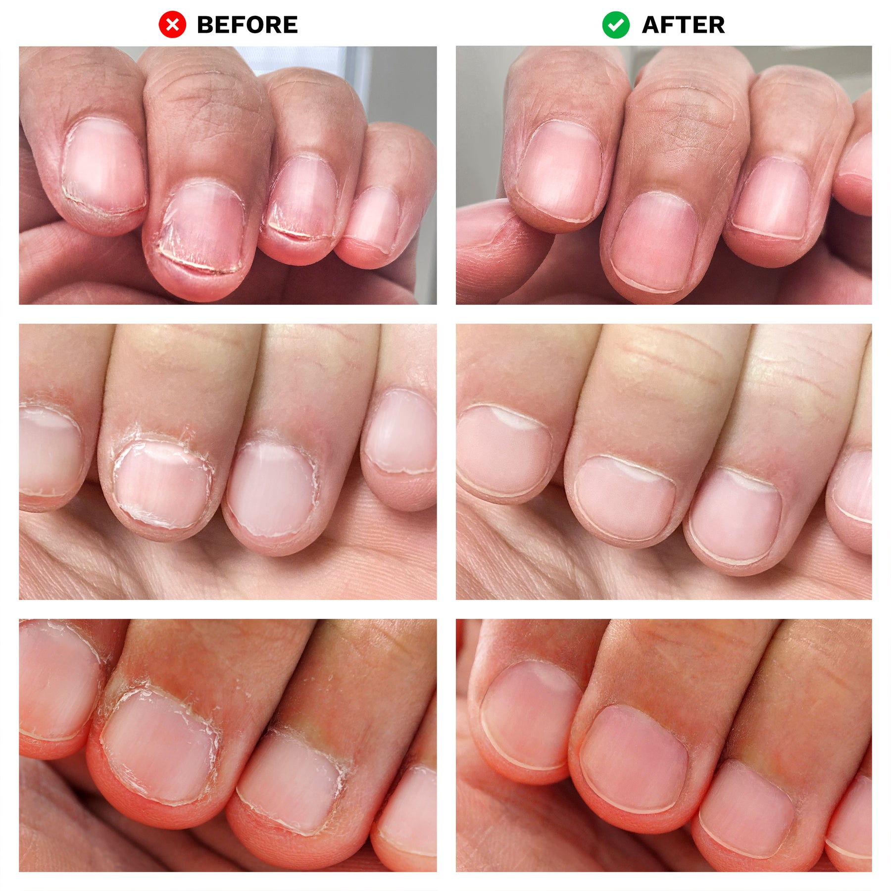 Nail polish for biting nails deals